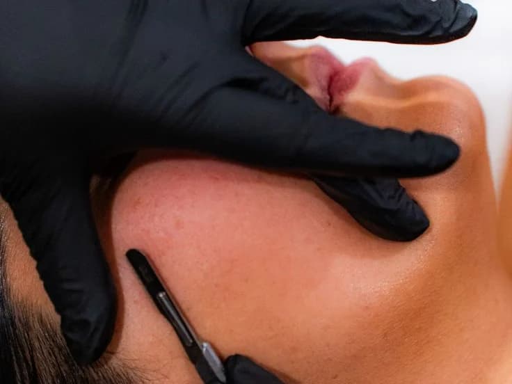 Dermaplaning facial