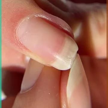 Nail fix / Extension on a broken nail