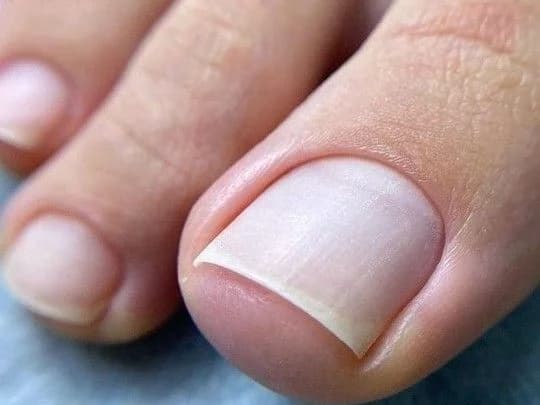 Removal of gel polish on toes